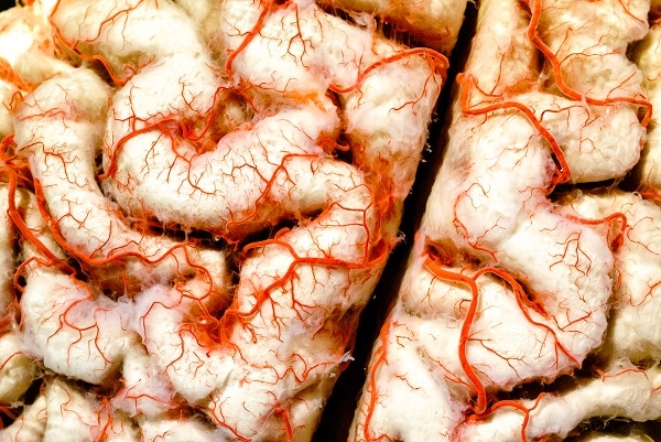 Human Brain